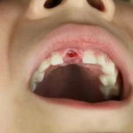 🦷 Descubre qué significa si sueñas que se te caen los dientes: ¡Una señal reveladora!