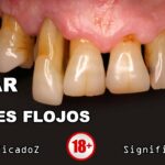 🦷🔍 ¡Descubre qué significa soñar con los dientes flojos! Todos los detalles aquí