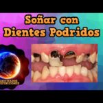 🦷💭 ¿Qué significa soñar con dientes podridos y que se me caen? Descubre su verdadero significado aquí